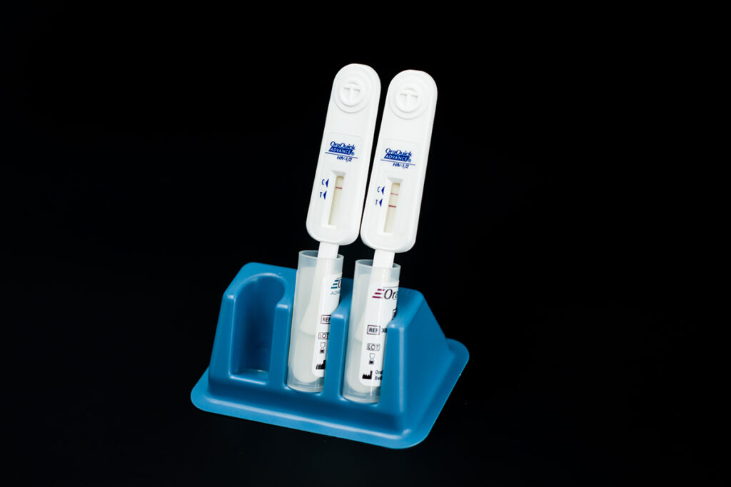 Test rápido de VIH y Hepatitis C